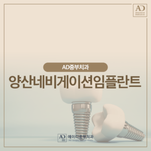 양산네비게이션임플란트