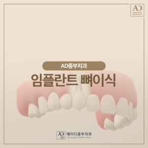 양산당일임플란트