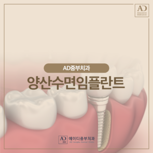 양산수면임플란트