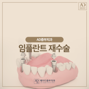 양산재수술임플란트