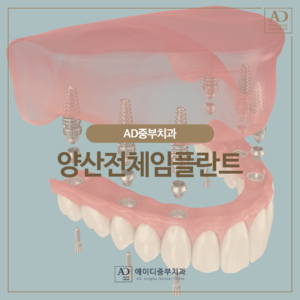 양산전체임플란트