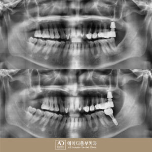 양산수면치과